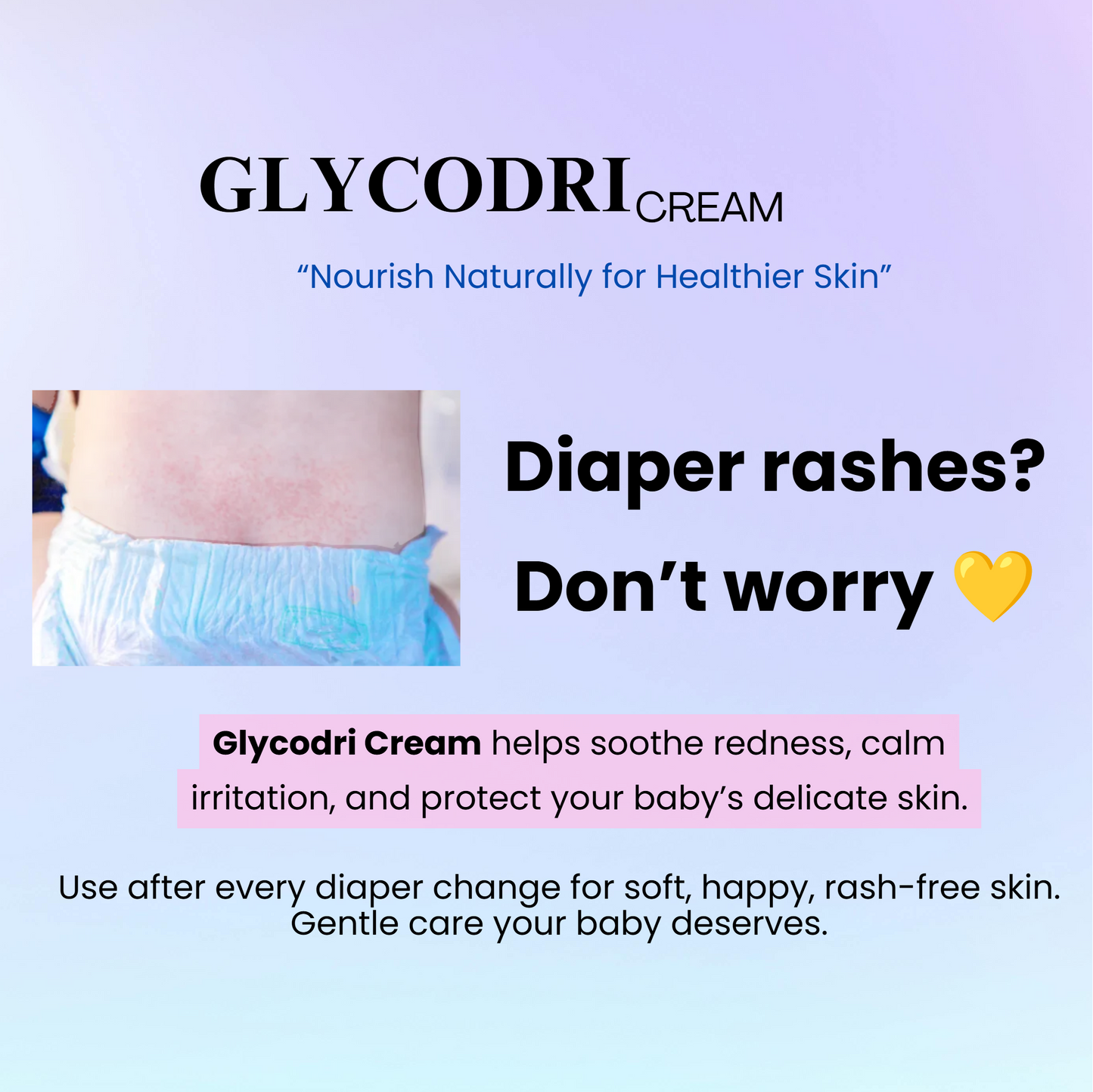 Glycodri Cream – Aloe Vera & Shea Butter – Dry Skin Relief
